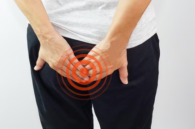 How to Effectively Treat an Itchy Bum
