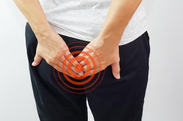 Itchy Bum Causes, Treatment and Prevention